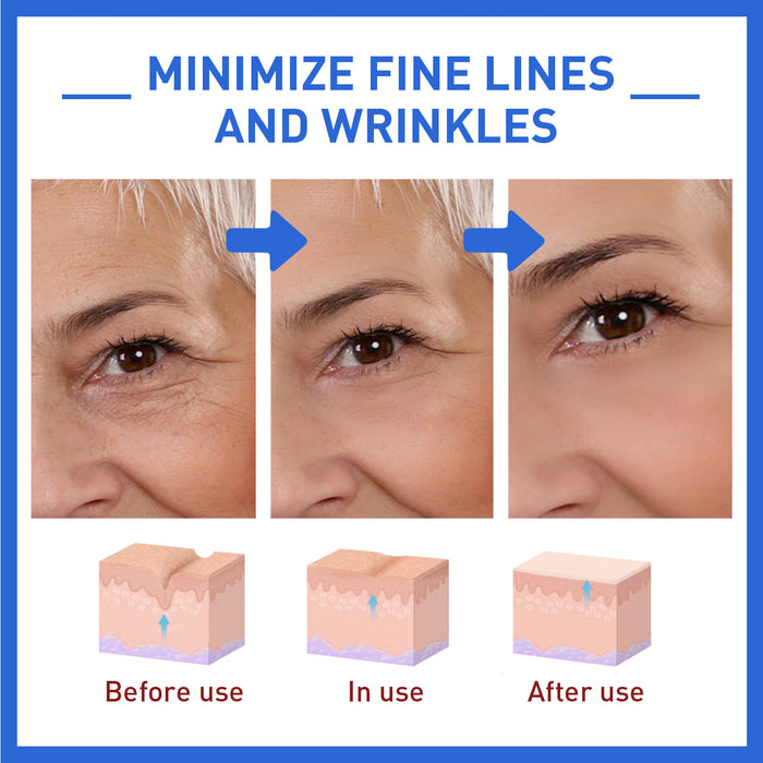 Anti-Wrinkle Essence Firming Head Lifting Pattern French Pattern Fading Wrinkle Botox Essence