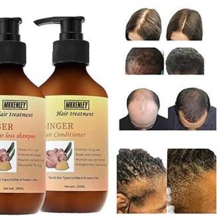 Best anti Hair Loss Ginger Shampoo and Conditioner 300ML Set