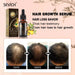 Hair Growth Serum | Anti Hair Loss Hair Serum 30ML